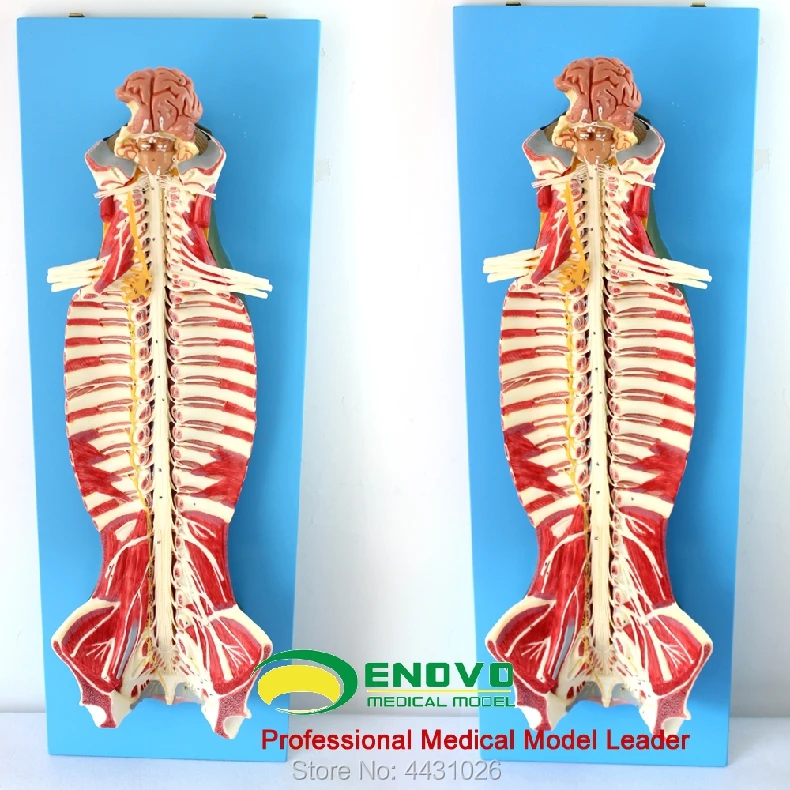 где купить ENOVO Anatomy of spinal cord spinal nerve по лучшей цене