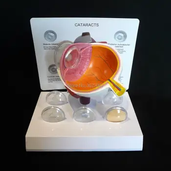 

Anatomical Medical traumaticPolar Bear Anatomy Model Professional Magnified Pulmonary Alveoli Joint Simulation