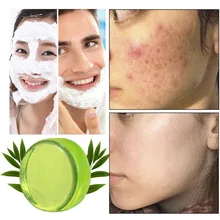 Мыло ручной работы эфирное масло мыло от акне успокаивающее масло контроль чистящее мыло увлажняющее средство для удаления черных точек цена