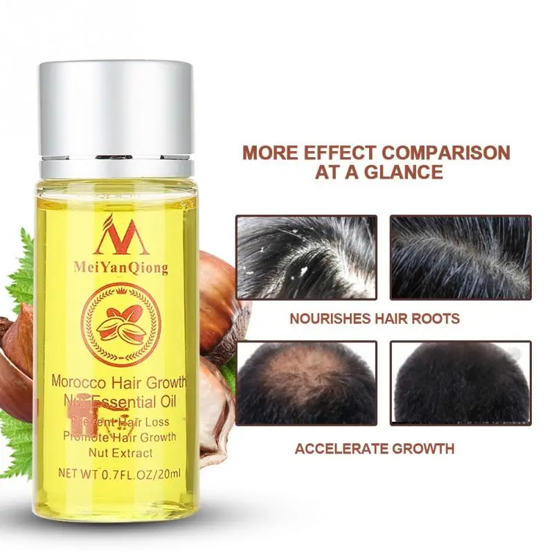 

Fast Powerful Hair Growth Essence Renewing Penetrating Essential Product For All Hair Types