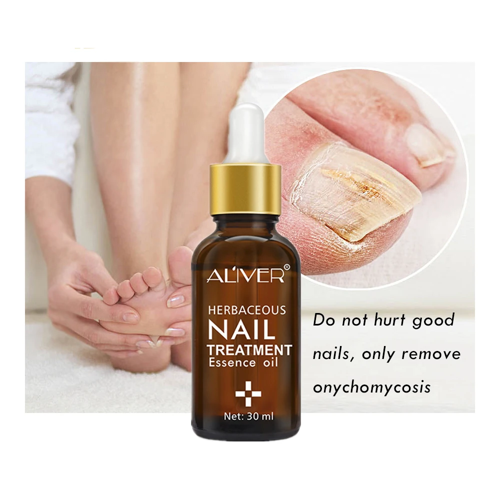 Nail Protector Skin Care Cream Nail Fungus Treatment Herb Nails Repair Cream Onychomycosis Paronychia Anti Fungal Nail Care Nail Protector Skin Care Cream Nail Fungus Treatment Herb Nails Repair Cream Onychomycosis Paronychia Anti Fungal Nail Care