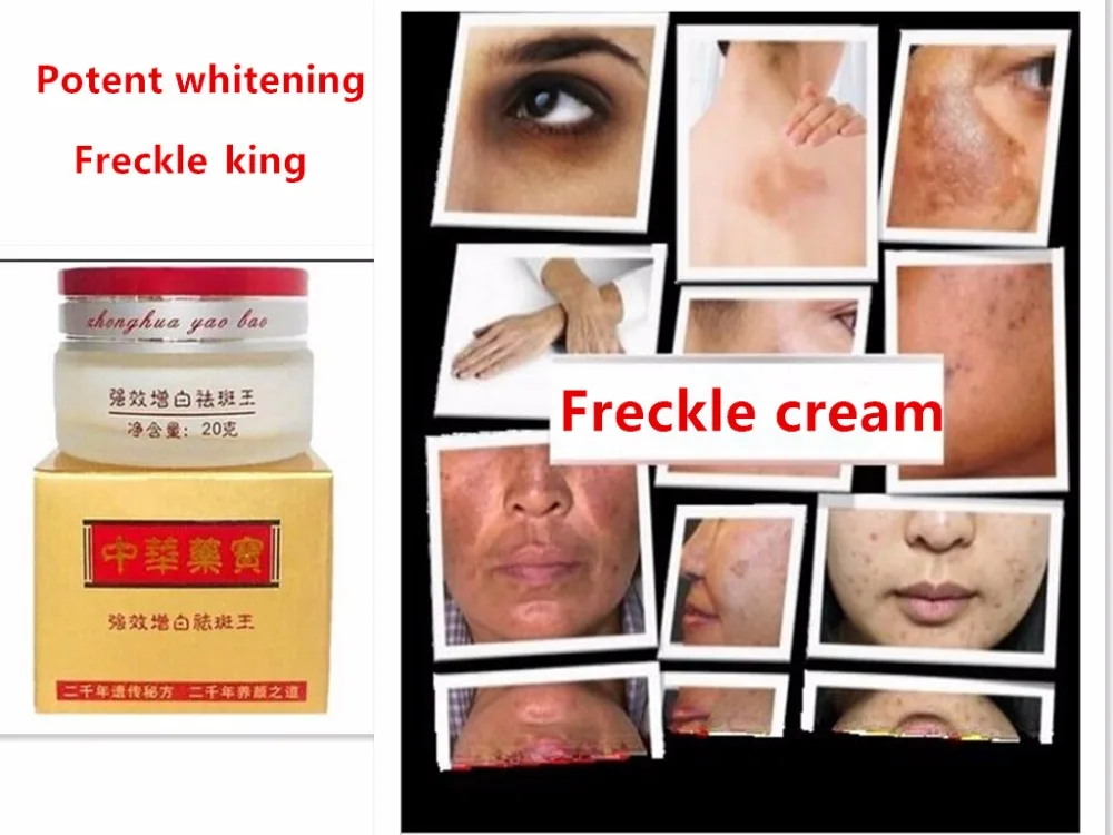 

Powerful Freckle Removal Cream Whitening Face Cream Dilute Melanin Remove Stains Sunburn Eliminate Melanin Face Care