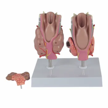 

Thyroid pathology model throat anatomy thyroid disease model