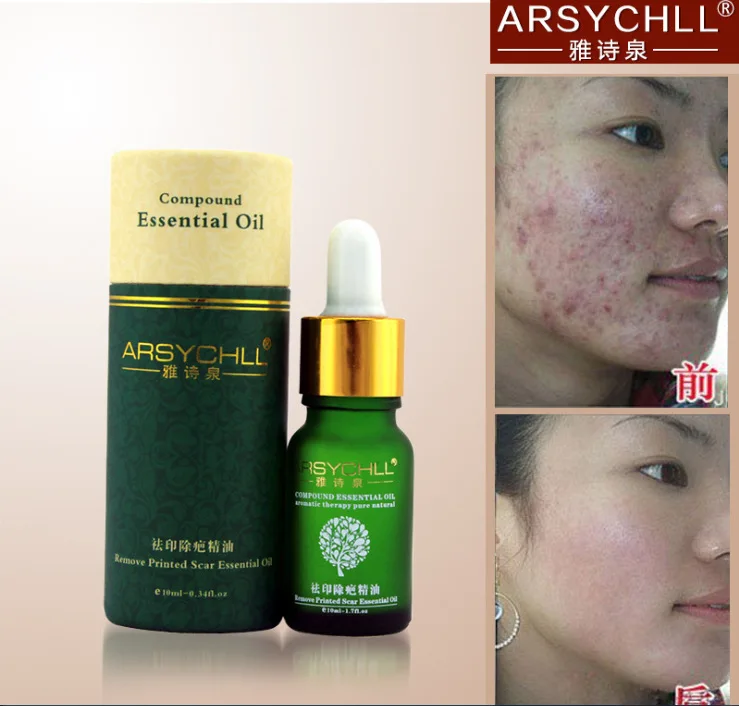 

Effectively Remove Scar Essential Oil Treatment Stretch Marks Whitening