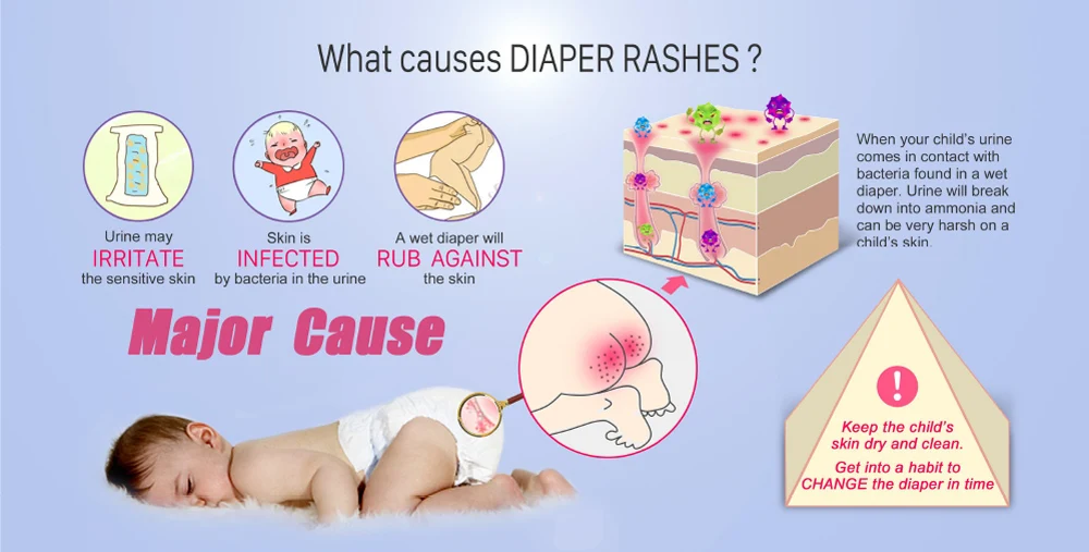 Diaper-Sensor_20170809-3