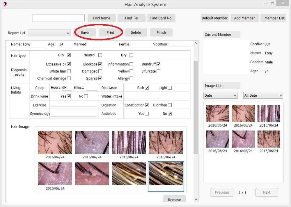 2019 New 8.0 MP High Resolution Digital CCD USB Multifunction UV Skin and Hair Analyzer Skin Camera Diagnosis Skinscope DHLfree 2019 New 8.0 MP High Resolution Digital CCD USB Multifunction UV Skin and Hair Analyzer Skin Camera Diagnosis Skinscope DHLfree