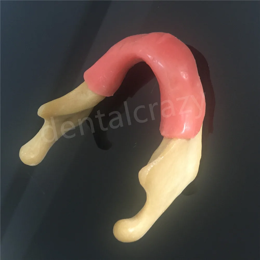 Стоматологическая силиконовая скоба с мягкой тканью для модель зубного импланта