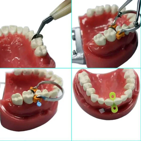 CE/FDA одобренный стоматологический секционный контурный Набор матриц/стоматологический набор матричных полос