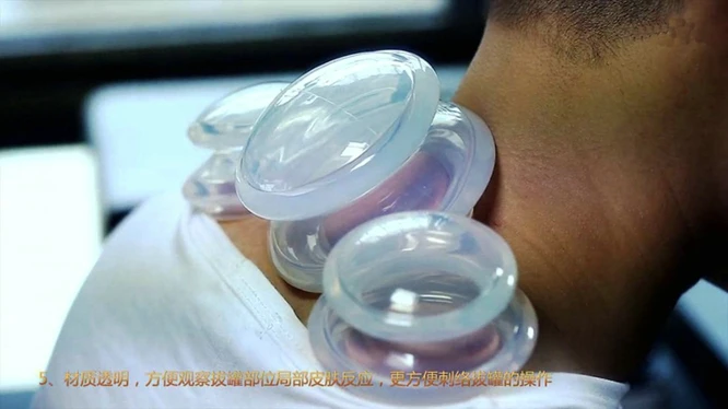 4pcs Vacuum Cupping Cups Transparent Silicone Face Beauty Clearing Damp Body Massage Slimming Helper Suction Cup Anti Cellulite 3