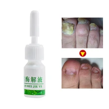 Ногтями сущность ногти и ноги отбеливающий ногти гриб удаление Кутикулы Нефти лечения Ногтей