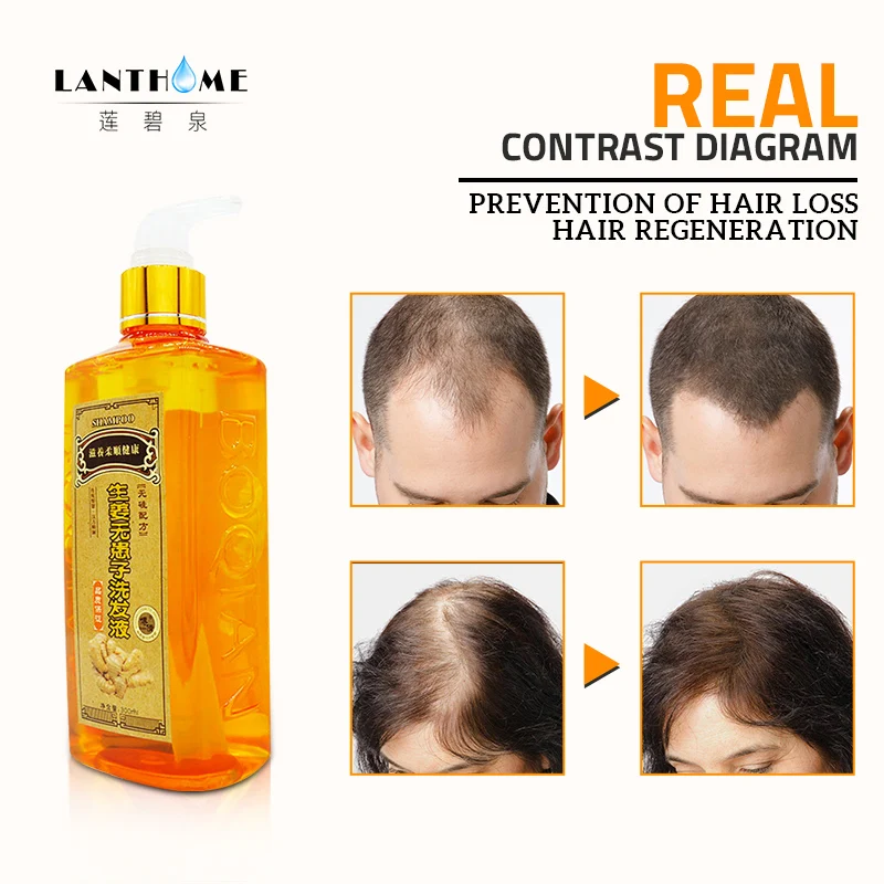 Pаспродажа Professional Hair имбирный шампунь 300 мл, волосы Regrowth плотные быстро, толще, шампунь против выпадения волос ремонт продукта питают эластичной