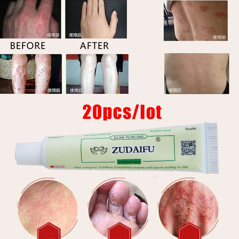 

20pcs/lot ZUDAIFU Chinese Ointment Plaster Inching Eczema Massage Cream Works Perfect For All Kinds Of Skin Problems 15g