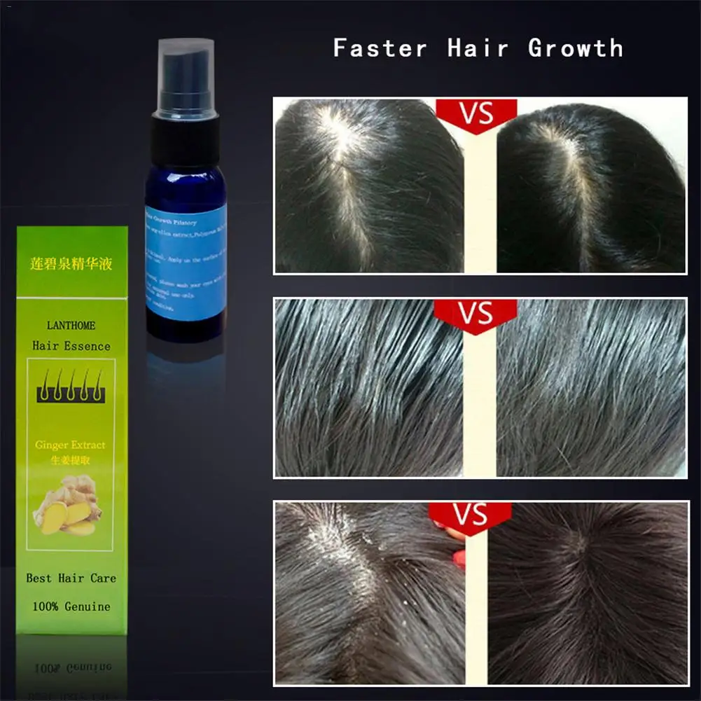30ml Thick Hair Essence Hair Fast Growth Treatment Nourishing Liquid Hair Care Oil Prevent Hair Loss Product 30ml Thick Hair Essence Hair Fast Growth Treatment Nourishing Liquid Hair Care Oil Prevent Hair Loss Product