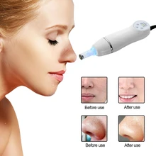 Profession Blackhead Removal Microdermabrasion Diamond Peeling Device Skin Peel Diamond Dermabrasion Facial Massage Skin Care