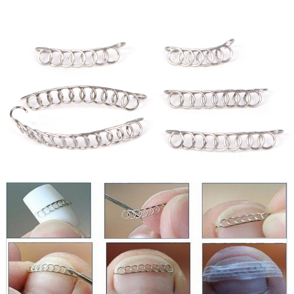 

6Pcs/Box Foot Care Tool Toenail Correction Wire Fixer Ingrown pedicure Recover Paronychia Acronyx Bunion Corrector