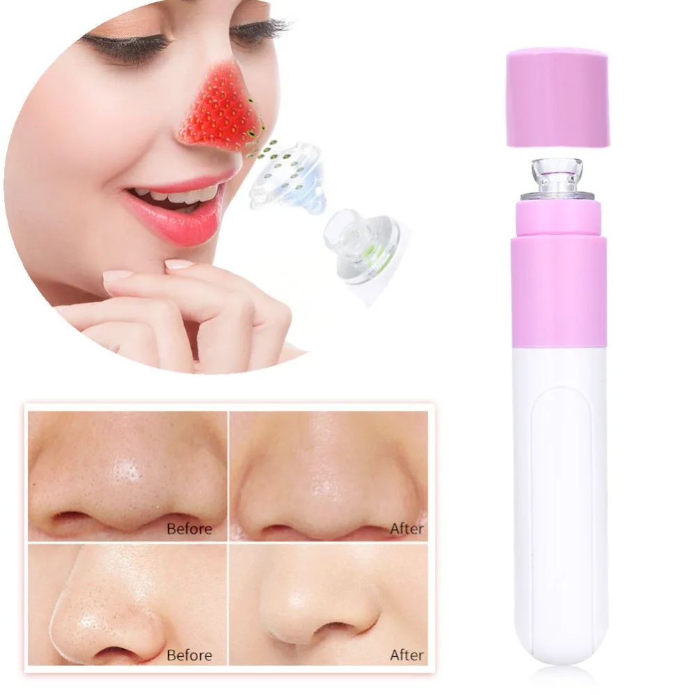 Vacuum facial massage: reviews. Vacuum facial massage: step by step description, efficiency Vacuum facial massage: reviews. Vacuum facial massage: step by step description, efficiency