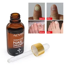 30 мл крем для ухода за ногтями Лечение грибка эфирное масло трав ногтей ремонт крем Onychomycosis Paronychia противогрибковые