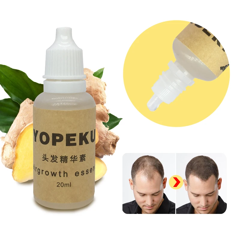 YOPEKU имбирное масло для роста волос растительное эфирное масло быстрее рост волос шампунь лечение повреждения анти выпадение волос жидкость 20 мл