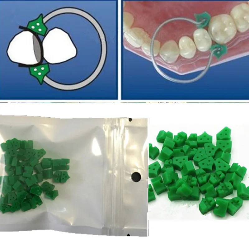 40Pcs Add-On Autoclavabile In Gomma Di Silicone Elastico Cunei Dentale Materiale Utilizzato Con Anello
