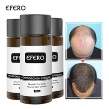 EFERO 2 шт быстро мощная эссенция для роста волос, продукты для выпадения волос, Эфирное лечение для мужчин, для женщин и мужчин, продукты для ухода за волосами, 20 мл