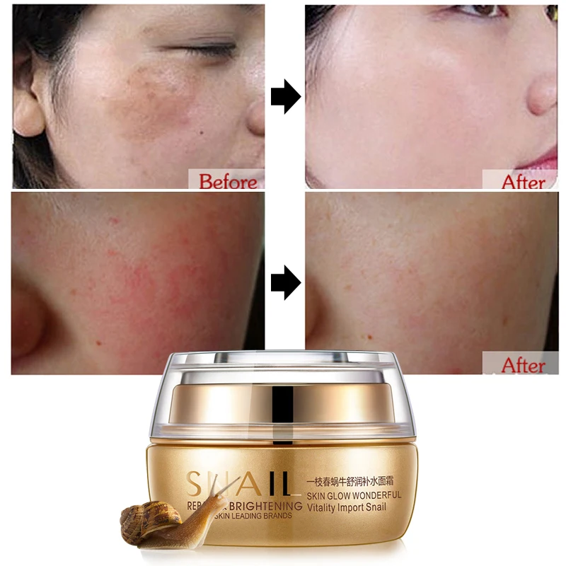 

OneSpring Snail Essence Face Cream Moisturizing Whitening Dark Anti-aging/wrinkle Skin Care Remove Fine Lines Spot Shrink Pores