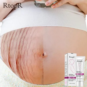 

Mango Remove Pregnancy Scars Acne Cream Stretch Marks Treatment Maternity Repair Anti-Aging Anti Winkles Firming Body Cream