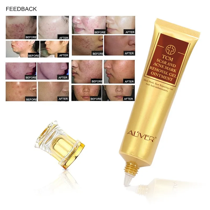 Buy Skin Care Remove Scar Repair Cream Pigmentation