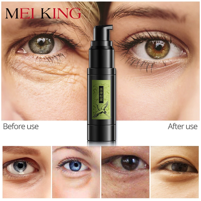 

MEIKING Hyaluronic Acid Collagen Crystal Gel Eye Serum Anti-Wrinkle Remover Dark Circles Eye Essence Against Puffiness Whitening