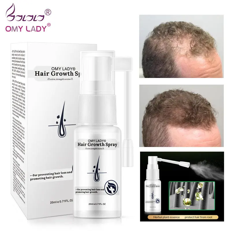 

20 Ml Anti-Hair Loss Growth Spray Essential Oil Liquid Men Women Dry Hair Regeneration Repair Hair Care Swelling Root Fashion