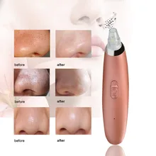 Средство для удаления черных точек, устройство для удаления черных точек, зарядка через usb, экстрактор, очиститель пор, электрический прибор для удаления черных точек, Очищающий Отшелушивающий массаж