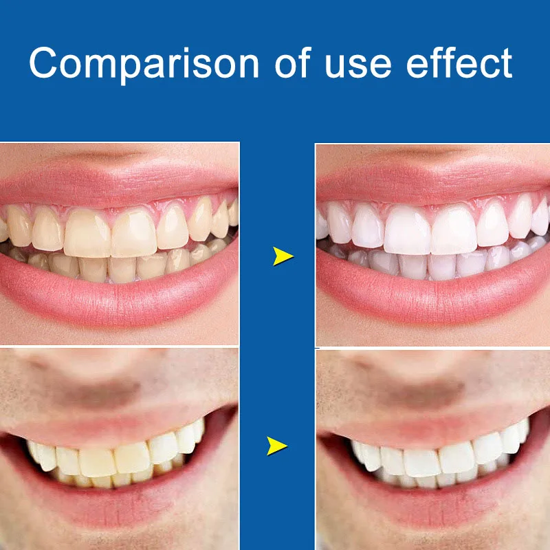 28pcs White Effects Whiten Strips Professional Teeth Whitening Strips