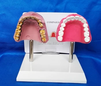 

Human traumatic pistol Mouth-Dangers of smokeless tobacco trauma medical instruments anatomy Anatomical Science Teaching model