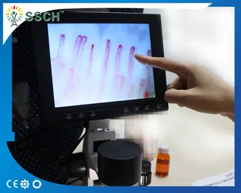 

Hot sale! CE approved &OEM biological microscope/blood capillary microscopes