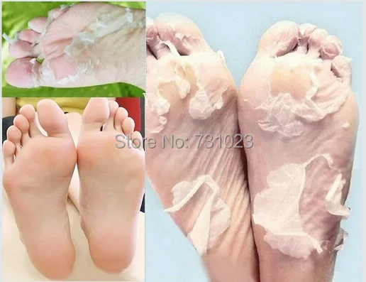 baby foot soins des pieds