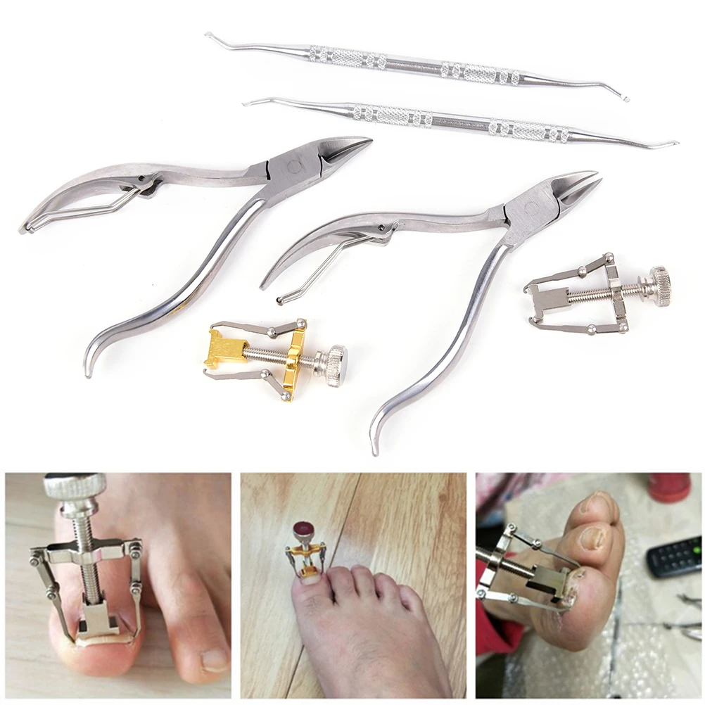 

3pcs/set Nail Correction Lifter Clipper Stainless Ingrown Toe Nail Fixer Pedicure Recover Embed Toenail Correction Lifter Tools