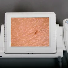 Все в одном 2,0 МП Разрешение CCD камера для анализа кожи с 8-дюймовым ЖК-дисплей монитора и 4 сравнить изображения DHL