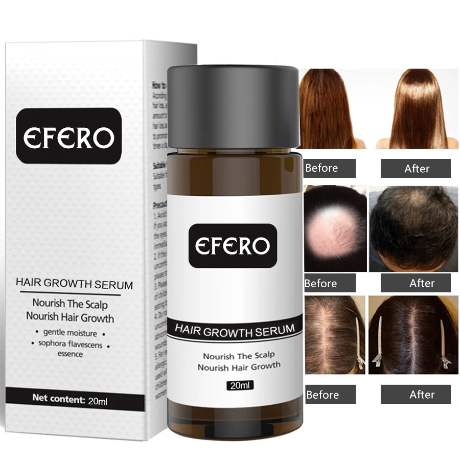 5PC Hair Growth Oils Anti Hair Loss Natural Treatment Essence Hair Dense Fast Regrowth Grow Restoration Serum Hair Care Products