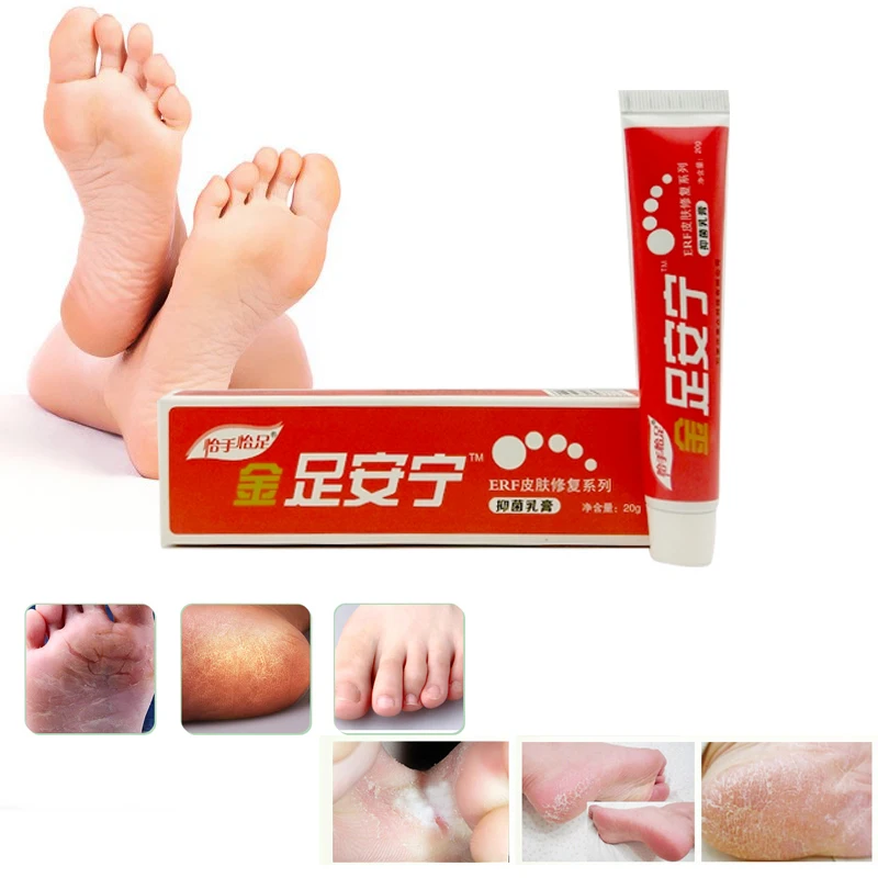 

Traditional Chinese Cosmetics Anti Dry Crack Repair Heel Feet Care Foot Balm Exfoliating Foot Creams Hand Cracked Heel Cream