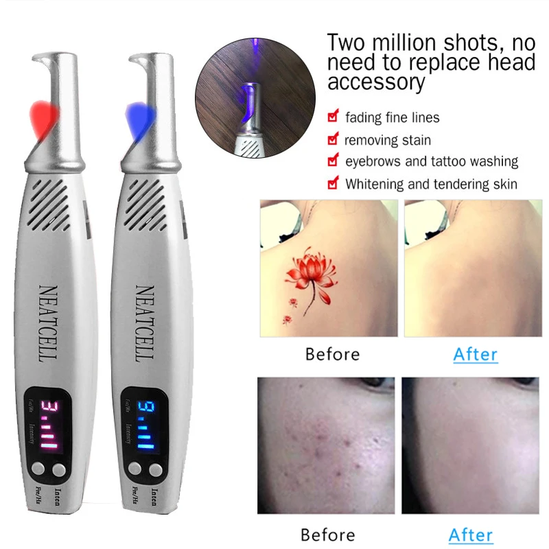 Portable Face Blemish Remover Picosecond Laser Pen Removal ...