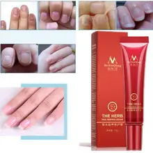 Китайский травяной Лечение ногтей онихомикоз параонихиа противогрибковые инфекция ногтей хороший результат травяной носок Лечение грибка