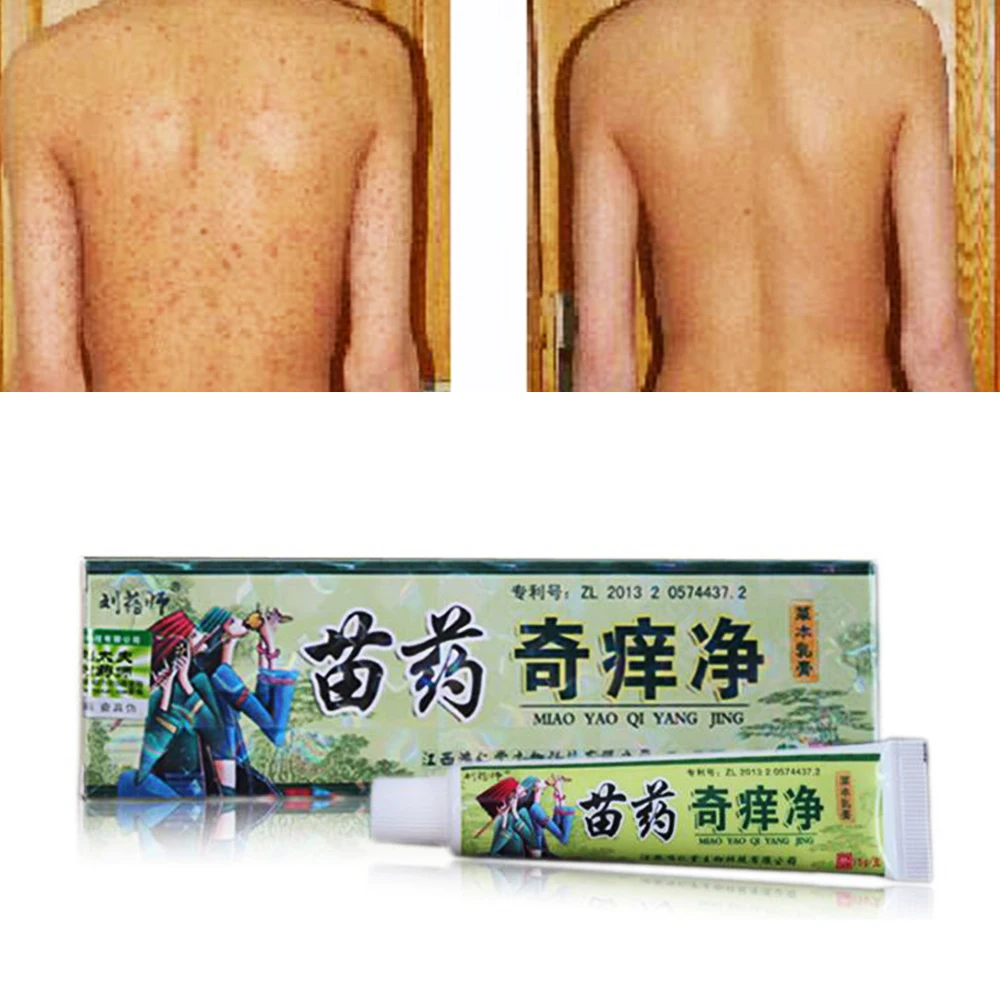 3 шт. китайский травяные кожи естественный уход за кожей мазь крем обезболивающее бальзам мазь псориаз Массажный крем D080