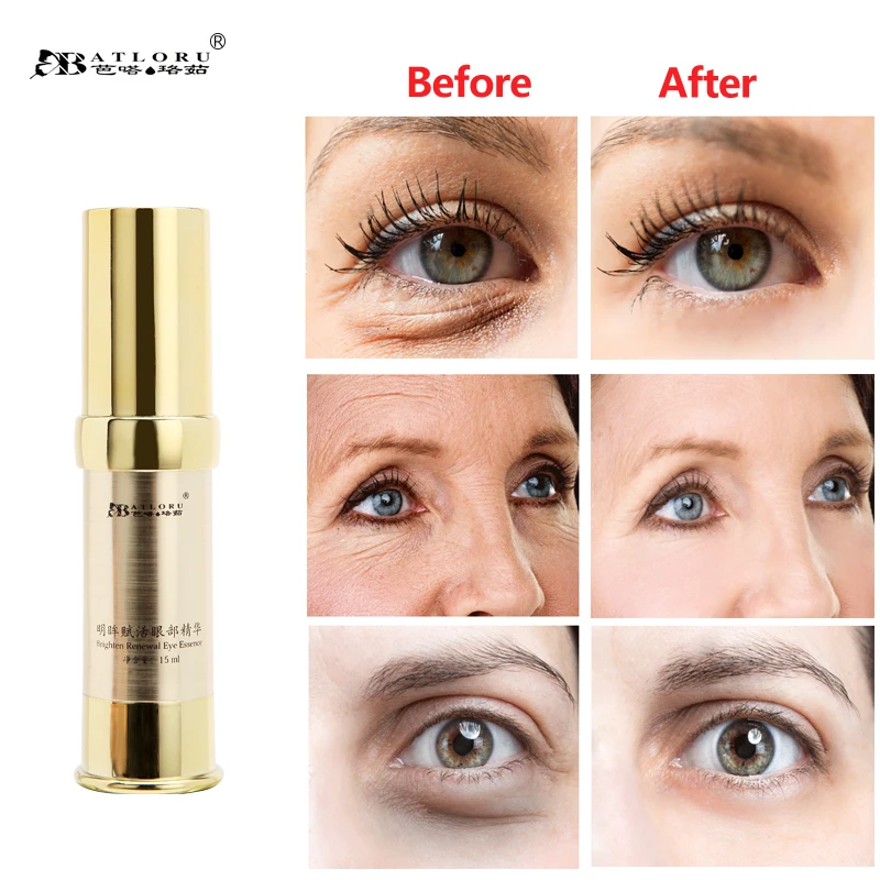 

Batloru Essence Eye Cream Moisturizing Dark Circles Anti-Aging Moisturizing Eye Cream CareAnti-Puffiness for Beauty 15g