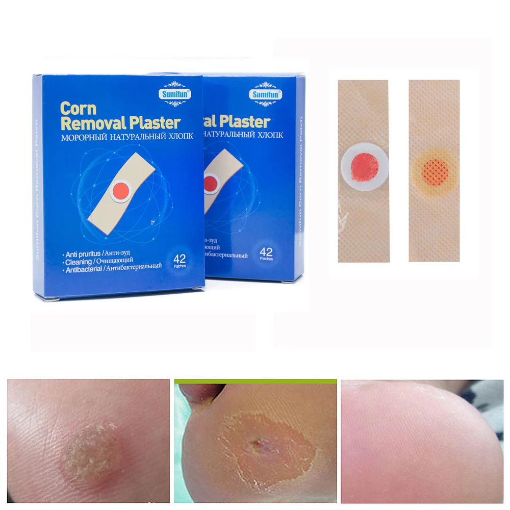 Sumifun 84Pcs Foot Corn Remover Calluses Plantar Warts Thorn Pain Relief Plaster Foot Care Tool Medical Sticker Toe Protector-2