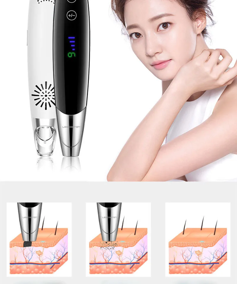 Remoção da Tatuagem Nível Laser Picosegundo Caneta Sarda Mole Ponto Escuro Sobrancelha Pigmento Acne Tratamento Máquina Beleza Cuidados 9 11 da tatuagem mole ponto escuro sobrancelha pigmento