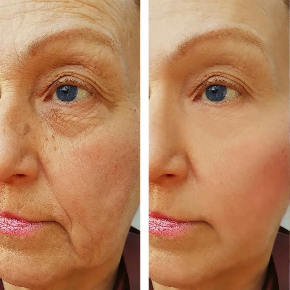 MABOX 30ml Hyaluronic Acid Serum+ Vitamin C Serum Anti-Aging Moisturizing Skin Care Firming Treatment Whitening Moisturizing