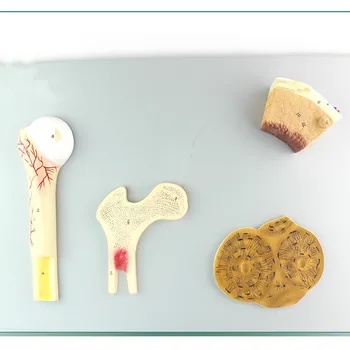 

Humans Bone Structure Model,Cancellous Bone,compact Bone and Femur Bone Haversian System Model ,medical Teaching Anatomy Model