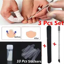 1/3 шт вросший Носок, коррекция ногтей, педикюр, закрепитель для ногтей на ногах, инструмент для ухода за ногами, ортопедическая наклейка, коррекция ногтей