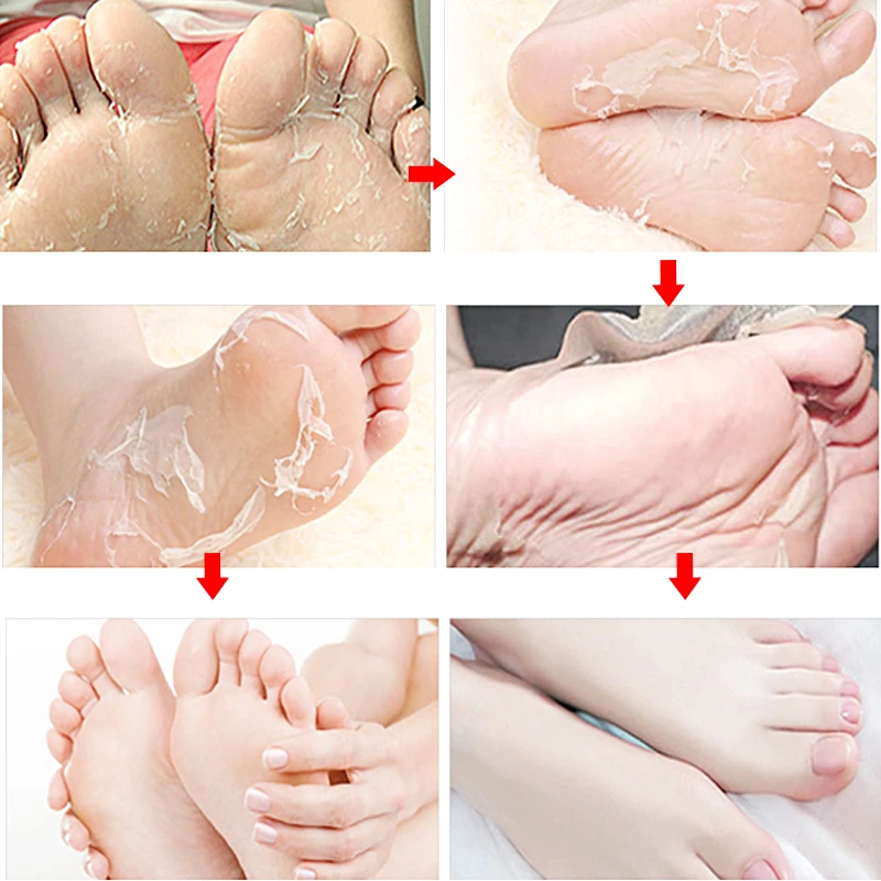6Pair/Set EFERO Foot Mask for Legs Pedicure Dead Skin Remove Whitening Exfoliating Mild Baby Feet Masks Heels Skin Care Socks 6Pair/Set EFERO Foot Mask for Legs Pedicure Dead Skin Remove Whitening Exfoliating Mild Baby Feet Masks Heels Skin Care Socks