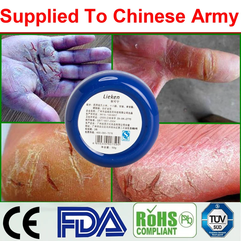 Мощный крем от трещин для рук для ног, против сухого обветренного крема, лечение сухой кожи, пятки, обветренный пилинг, ремонт китайской лекарственной мази