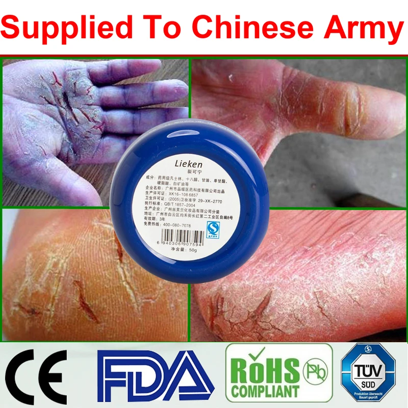 Powerfull Kaki Tangan Krim Retak Anti Pecah Pecah Kering Cream Perawatan Kulit Kering Tumit Pecah Pecah Mengupas Perbaikan Salep Obat Cina Skin Ointment Cream Ointmentchinese Ointment Aliexpress